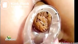 Shitting through speculum