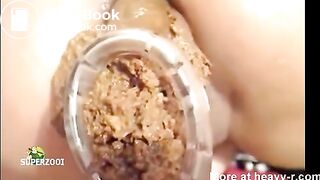 Shitting through speculum