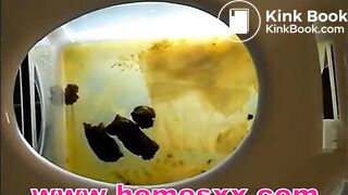 浣腸のスカートクリップ