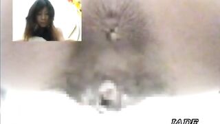 Asshole View 4