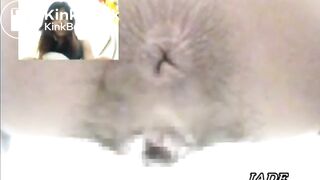 Asshole View 4