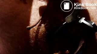 Shitting through speculum