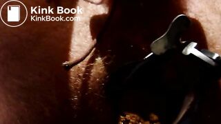 Shitting through speculum