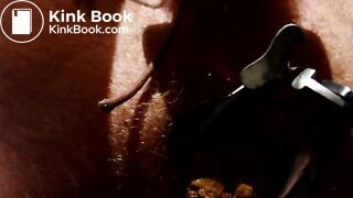 Shitting through speculum