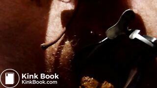 Shitting through speculum