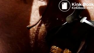 Shitting through speculum