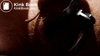 Shitting through speculum