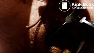 Shitting through speculum