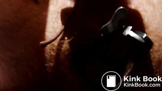 Shitting through speculum