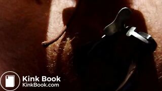 Shitting through speculum