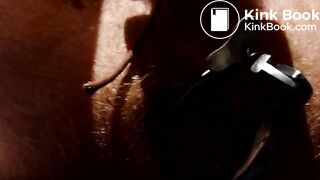 Shitting through speculum