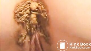 Squashed Shitty Butt Cheeks