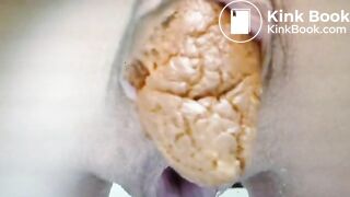 ultimate voyeur scat 2