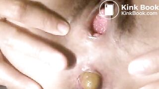 camvotze hat geschissen