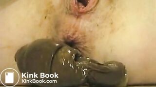 Stuffing Shit Filled Condom In Pussy