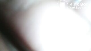 Nasty Diarrhea Close Up