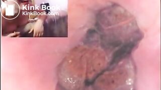 Three_russian_girl_in_anal_buttcam