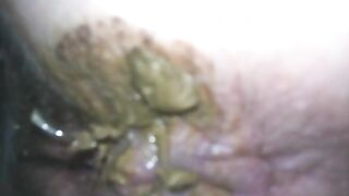 Wife dirty asshole after shit