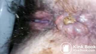 Turd stuck in her asshole