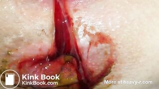 Morning Shit During Menstruation