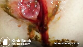 Morning Shit During Menstruation