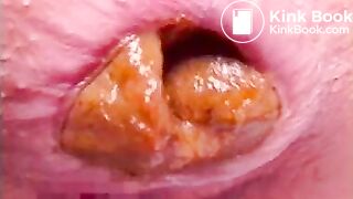 ranbu_soloscat_big_pile