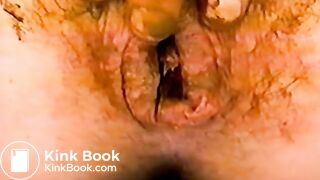 Scat - Closeup 04 - Scheisse