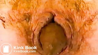 Scat - Closeup 04 - Scheisse