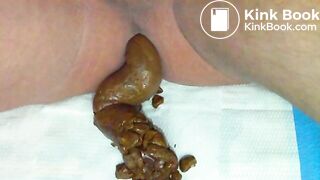 Kaviarpo nahaufnahme