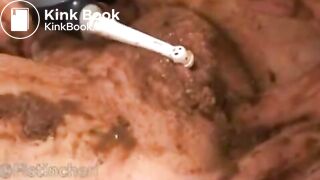 Fistinchen - Outdoor Fisting & Solo Scat