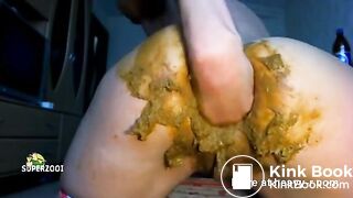 Shitty Self Fisting And Anal Prolapse
