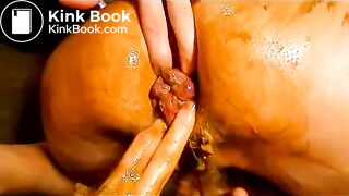 use-that-prolapse
