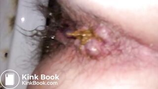 Wife shitting compilation