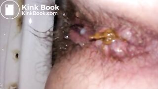 Wife shitting compilation