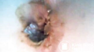 hammered the shit outta my asshole