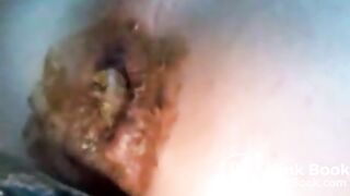 hammered the shit outta my asshole