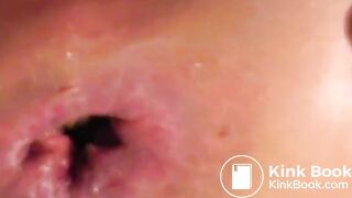 constipated asshole fucking