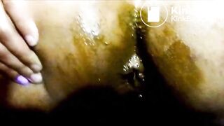 anal 2