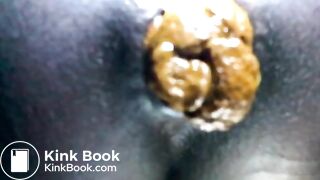 Black teen shitting close up
