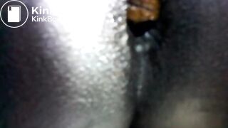 Black teen shitting close up