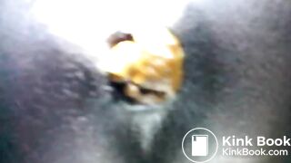 Black teen shitting close up