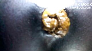 Black teen shitting close up