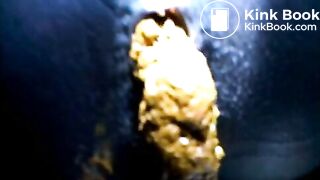 Black teen shitting close up