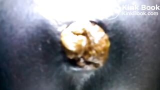 Black teen shitting close up