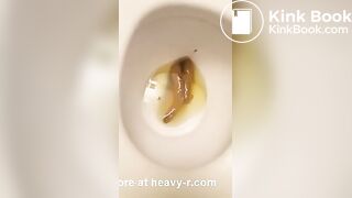 Kurt observes his nice poop