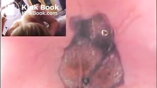 Three russian girl in anal buttcam