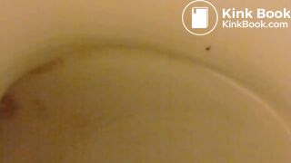 Video 17