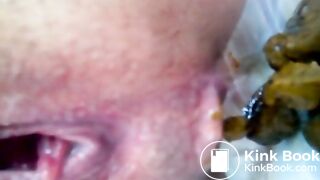 Close Up Shitting Anus