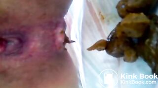 Close Up Shitting Anus