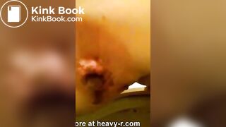 Super Close Up Shitting